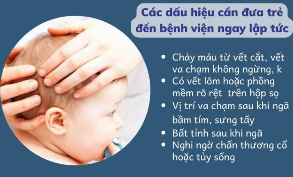 Trẻ bị té u trán, làm gì khi trẻ bị ngã sưng trán